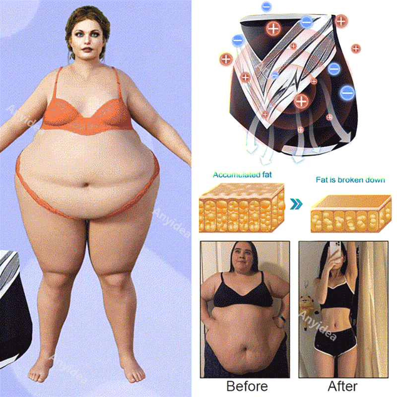 Titanium Fiber Self-heating Tourmaline Shaping ShortsđRecommended by British Medical Association(BMA)