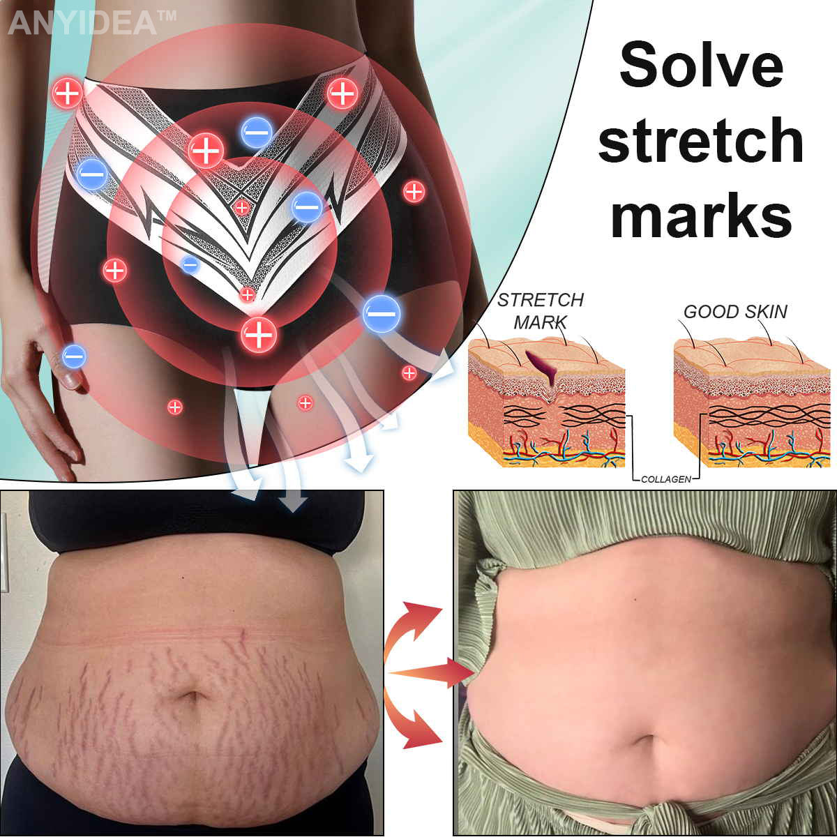 Titanium Fiber Self-heating Tourmaline Shaping ShortsđRecommended by British Medical Association(BMA)