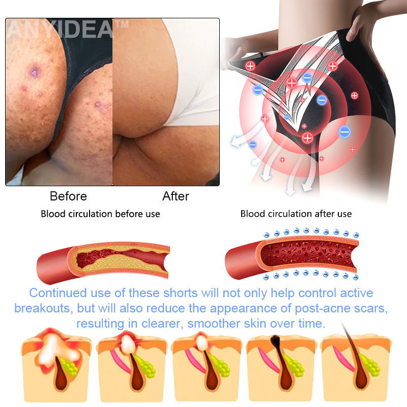 Titanium Fiber Self-heating Tourmaline Shaping ShortsđRecommended by British Medical Association(BMA)